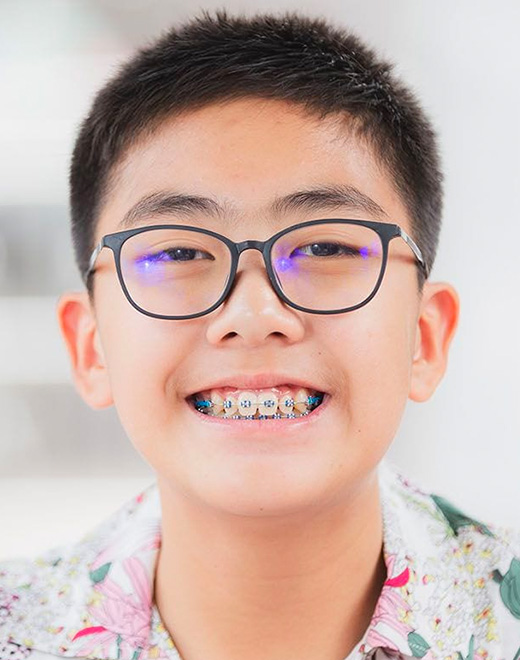 Braces treatment image from Abraham Orthodontics